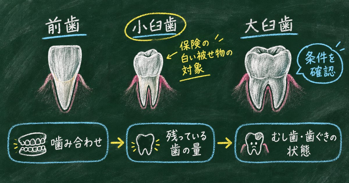 保険で白い被せ物にできる？歯の位置と状態から確認