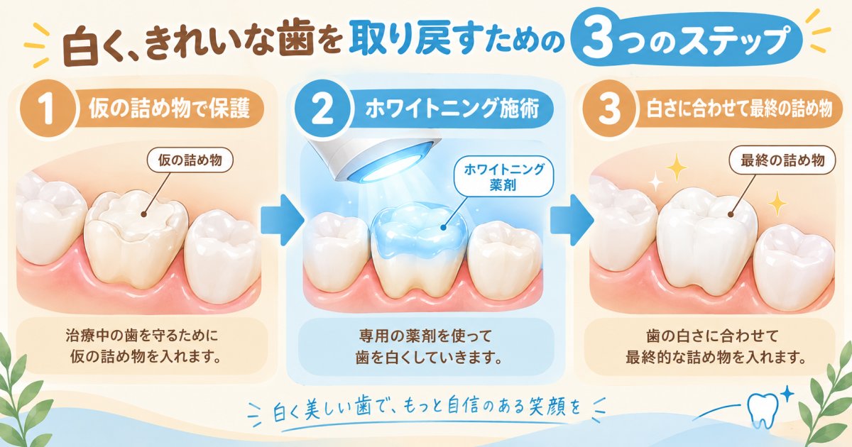 むし歯治療とホワイトニングの順番、前歯の詰め物の色を合わせる手順