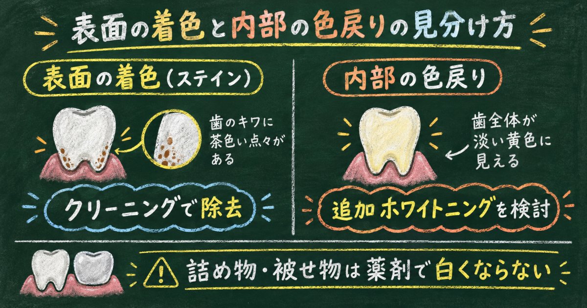 表面の着色か色戻りかを見分けてクリーニングと追加施術を選ぶ